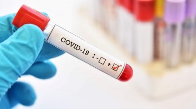 Covid-19 : Plus de 8 mille contaminations et 14 décès 