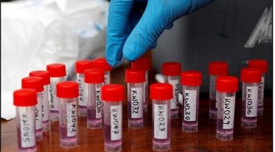 Tunisie-Covid19: 920 nouveaux cas de contamination, et 17 décès supplémentaires