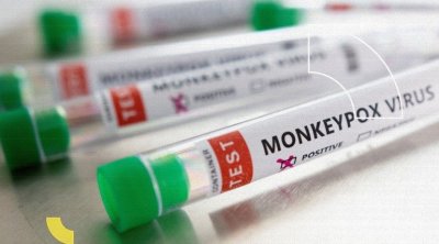 منظمة الصحة العالمية : جدري القردة لن يتحول إلى وباء 