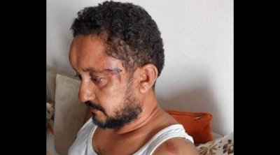 إيقاف 3 أعوان أمن عن العمل وفتح بحث اداري في حادثة الاعتداء على الصحفي سفيان بن نجيمة