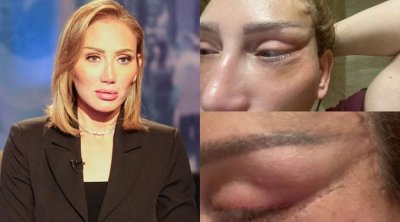 قضية ريهام سعيد..هل تحقق توقع ليلى عبد اللطيف بخصوص أطباء التجميل؟