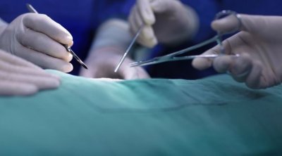 Première en Tunisie : Ablation d’une tumeur au cerveau sur une patiente éveillée