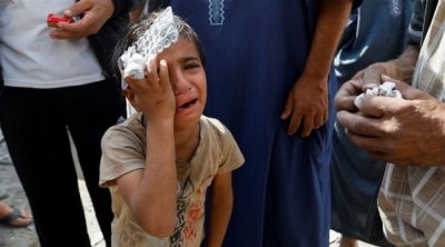 كولومبيا ستستقبل أطفالا فلسطينيين أصيبوا في الحرب على غزّة