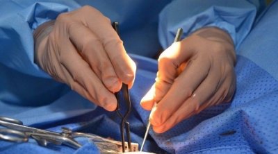 إنجاز طبي جديد بالمستشفى الجهوي بالمتلوي : استئصال ورم معقد بنجاح