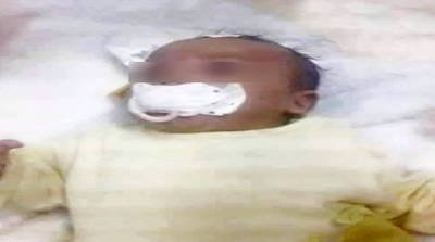 في مستشفى الهادي شاكر بصفاقس : شريط لاصق على فم رضيع حديث الولادة 