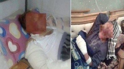  فتح تحقيق في طرد مريضان من المستشفى الجامعي ببنزرت بسبب تعفن جسديهما 