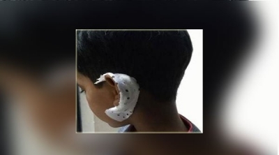 القصرين : معلم يعتدي على تلميذ في السنة اولى ابتدائي و يتسبب له في شرخ بأذنه 