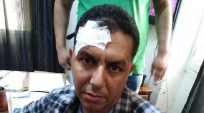 Un vendeur ambulant agresse un agent de la police municipale 