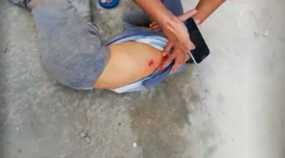 Sijoumi : Décès du jeune homme touché par balles