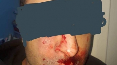 Un médecin violemment agressé à l’hôpital de Ben Arous