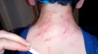 Hammam-Lif :Un élève battu par son enseignant dans une école