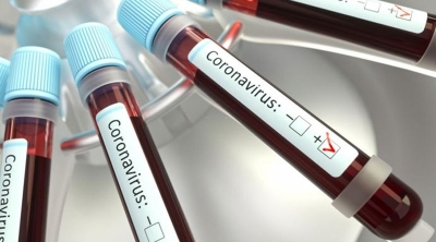 Covid-19 : 2 décès et 9 nouvelles contaminations à Jendouba 