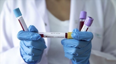 Covid-19: le Soudan reçoit son premier lot de vaccins