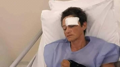 الممثلة ريم الزريبي تتعرض إلى حادث مرور