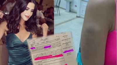 إعلامي تونسي مشهور يعتدي بالعنف على خطيبته السابقة (صور)