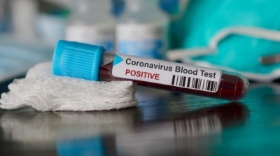 Covid-19 :2 décès et 42 nouvelles contaminations le 24 Octobre 2021